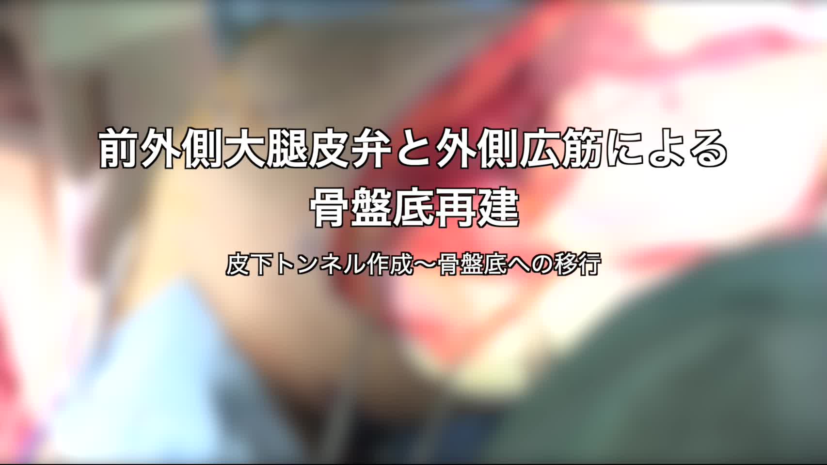 80-06-103赤澤論文　動画３　図6　皮下トンネル〜骨盤底移行...