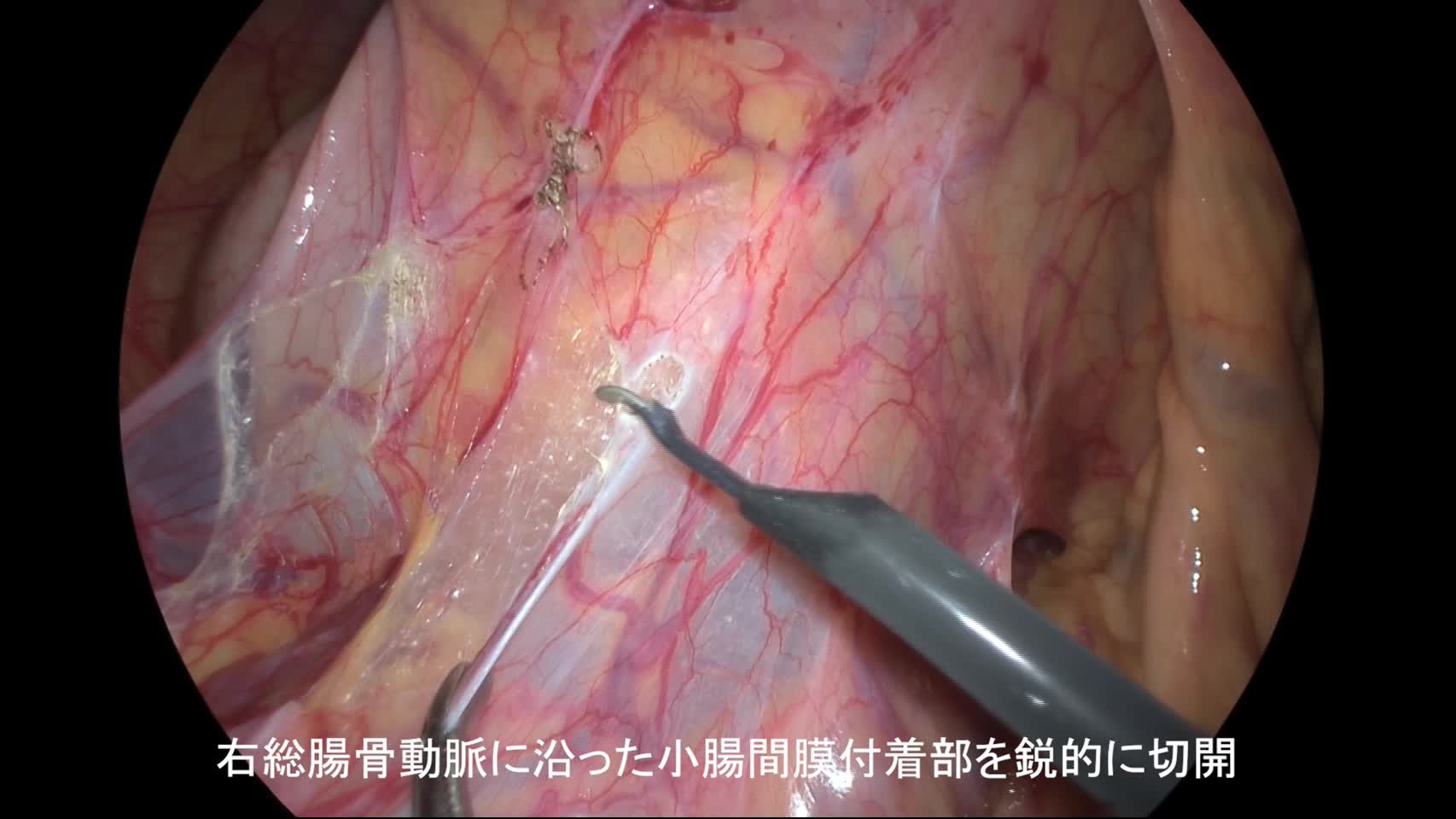 80-01-05-1（図2-5）
