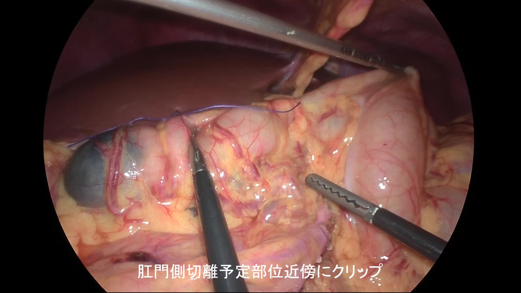 80-01-05-4（図9,10）
