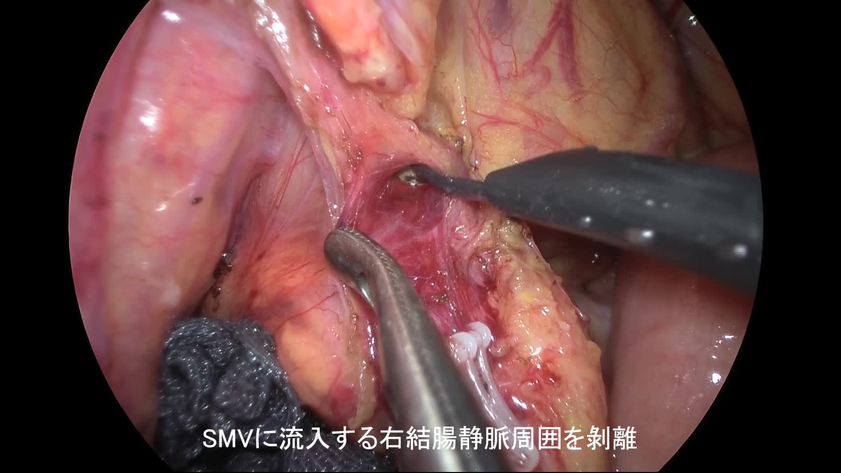 80-01-05-5（図11）