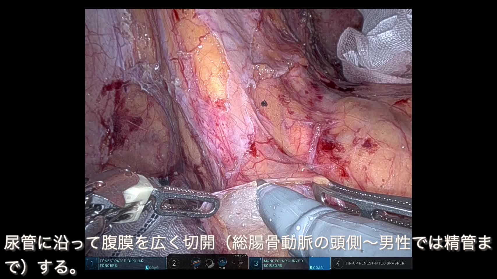 81-01-16-2（図3～11）