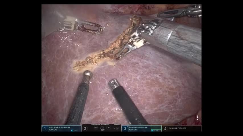 810503 図6