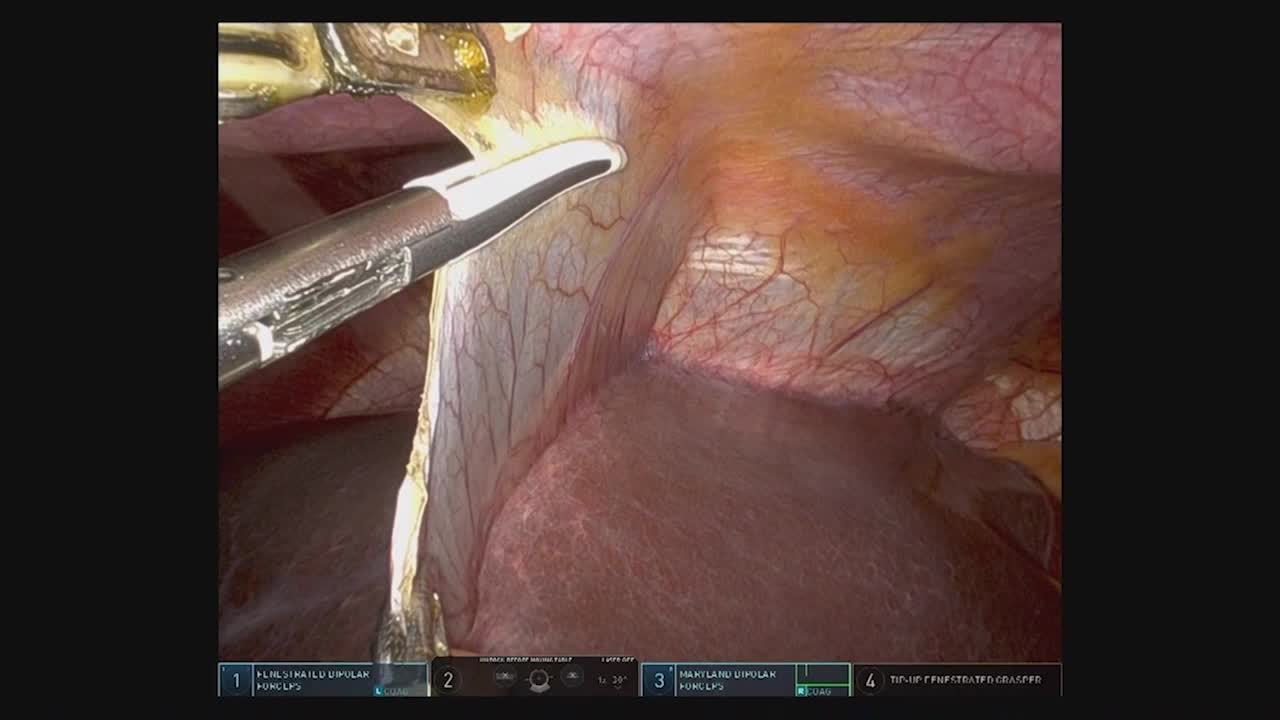 810617 江原論文　図3