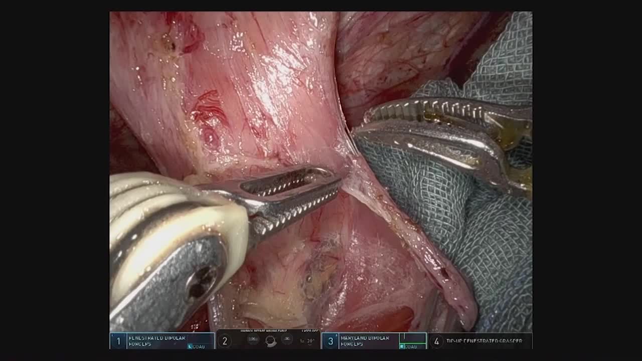 810617 江原論文　図7